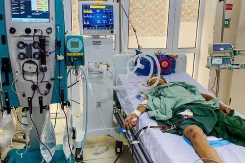 Hà Nội: Chỉ vài giờ sau khi mổ lợn chết, người đàn ông sốt rét rồi sốc nguy kịch