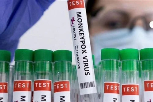 Bộ Y tế sẽ tạo điều kiện tối đa để sản xuất vaccine, thuốc chữa đậu mùa khỉ trong nước