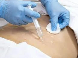 Nữ sinh lớp 11 ở Hà Nội giấu gia đình đi tiêm tan mỡ giảm béo, phải nhập viện vì biến chứng