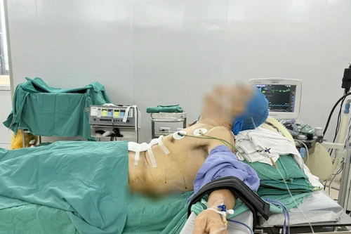 Hiếm gặp: Bệnh nhân ung thư dạ dày được phẫu thuật ở tư thế… nửa nằm nửa ngồi