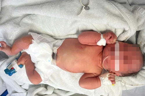 Hà Nội: Tìm người thân bé gái sơ sinh bị bỏ rơi trong bụi chuối, côn trùng đốt khắp người