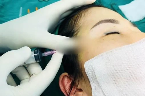 Nhiều người nhập viện vì “đập đi xây lại” gương mặt cho hợp phong thủy