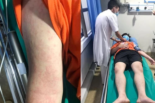 Nam thanh niên sốc phản vệ nguy kịch vì bắt con mối để nấu ăn