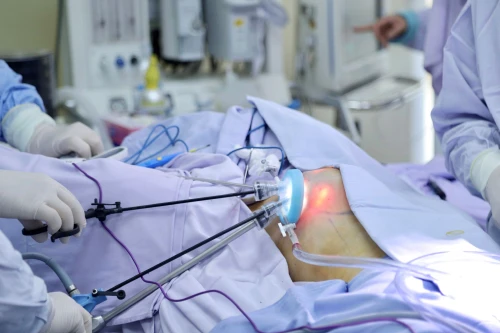 Lần đầu tiên nội soi 1 lỗ cắt tuyến vú điều trị ung thư kết hợp tạo hình thẩm mỹ ngực