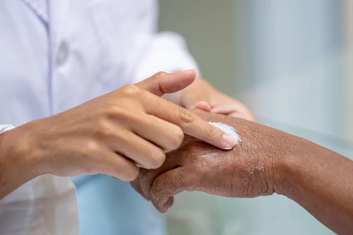 Thời tiết hanh khô khiến bệnh về da tăng, dễ diễn biến nặng, bác sĩ khuyến cáo cách chăm sóc