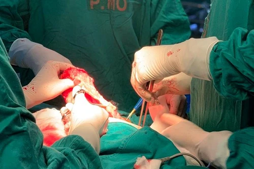 Bác sĩ nêu các dấu hiệu của ung thư vú, có thể điều trị hiệu quả nếu phát hiện sớm