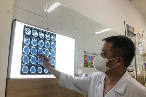 Tin mới vụ công nhân ở Bắc Ninh nhiễm độc methanol: 108 người nhập viện, có ca tử vong, mù mắt