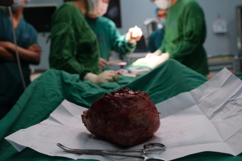 Cắt bỏ bướu giáp khổng lồ cho cụ bà 92 tuổi ở Hà Nội