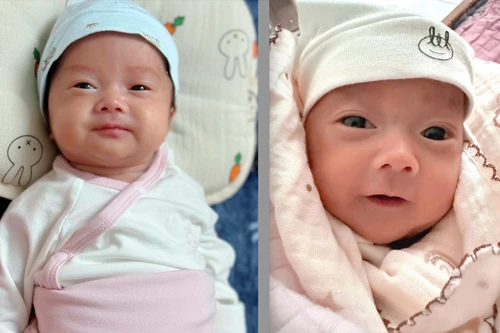 Hy hữu: Hai anh em sinh đôi chào đời cách nhau 5 tuần