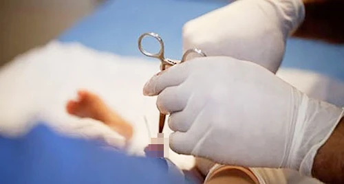 Thanh niên 18 tuổi tử vong khi tiêm thuốc gây tê để cắt bao quy đầu
