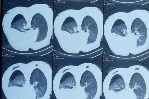 Hà Nội: Đang bán hàng, người đàn ông 44 tuổi bất ngờ bị đâm 3 nhát sau lưng xuyên thấu ngực