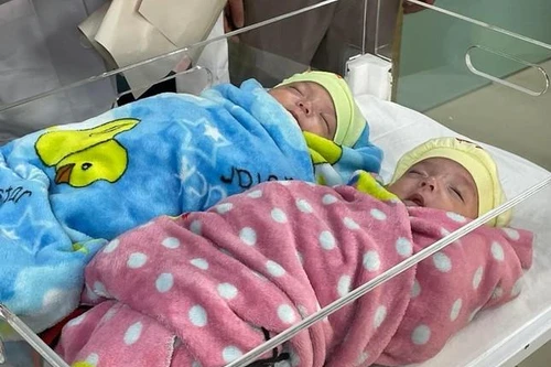 Kỳ tích: Cặp song sinh chỉ nặng 500g, chào đời khi thai mới 25 tuần được nuôi sống thành công