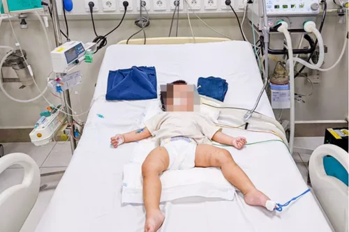 Tình trạng mới nhất của bé gái 18 tháng tuổi bị bạo hành tại Hà Nội: Có dấu hiệu chuyển biến khá hơn