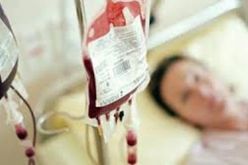 Truyền máu đã được lưu trữ hiệu quả hơn máu tươi