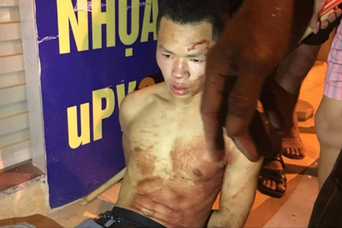 9x đâm thủng cổ tài xế cướp taxi trong đêm trên đường Võ Chí Công