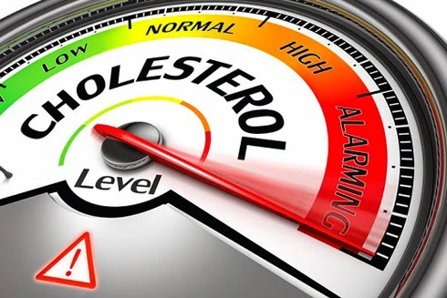 Nên kiểm tra cholesterol định kỳ