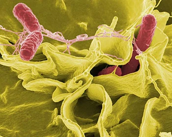 Nguyên tắc cơ bản phòng ngừa nhiễm khuẩn salmonella