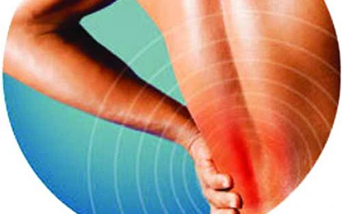 Đau thắt lưng, nguyên nhân hàng đầu gây liệt