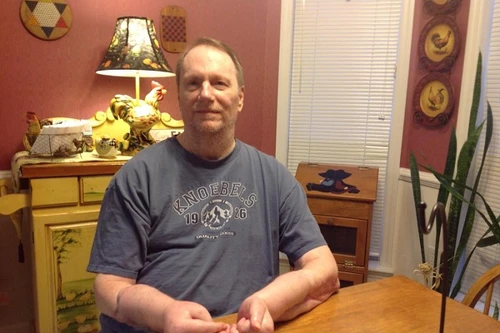  Người đàn ông muốn bỏ đi cả 2 cánh tay 