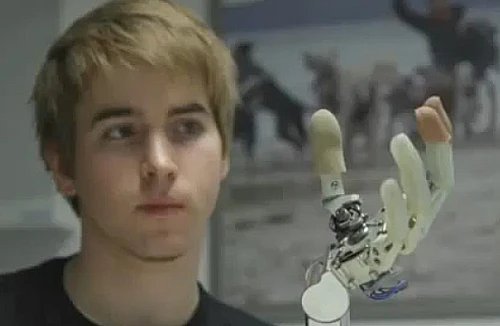 Thiết bị 3D hỗ trợ sử dụng chân tay giả