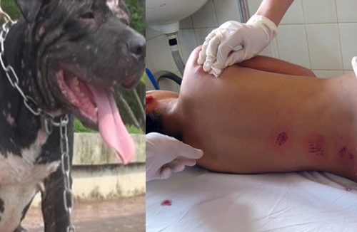 Hiểm hoạ từ việc nuôi chó Pit Bull 