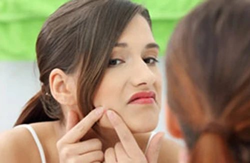 Triệt tiêu “thủ phạm” gây trứng cá 