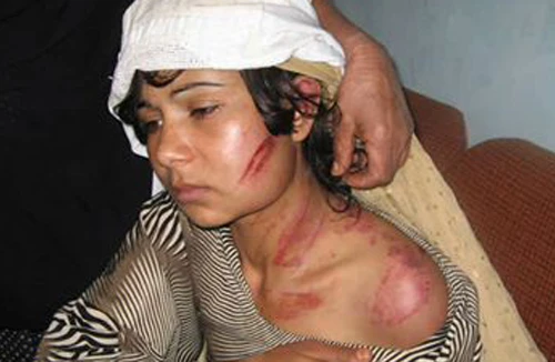 Nan giải nạn bạo hành phụ nữ 