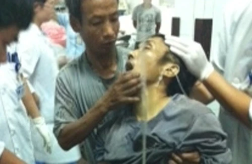 Bị máy nghiền gạch nghiến cụt 2 chân 