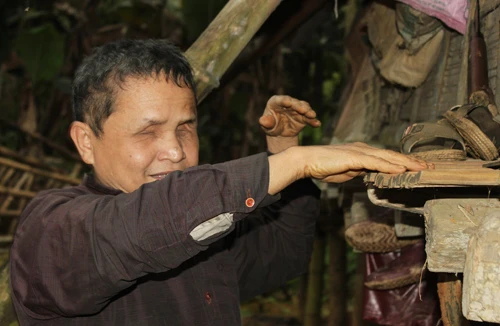 Kỳ diệu người đàn ông có “con mắt thứ 3” 