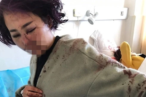 Trung Quốc xôn xao vụ mẫu trẻ bị 12 người đàn ông hành hung