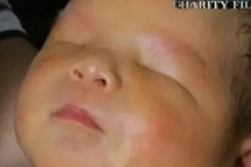 Mẹ trẻ tuyệt vọng cùng cực vì con trai sinh ra không có mắt