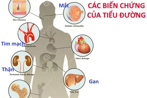 Khám và phát hiện sớm 10 bệnh lý nguy hiểm nhất thường gặp trong cuộc sống