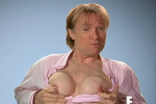 Nhận lời thách đố 100.000 USD, người đàn ông cấy ngực phụ nữ nóng bỏng 