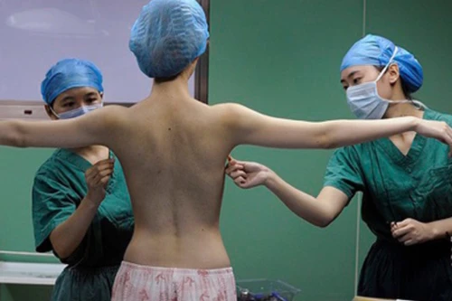 Mới: Người tâm thần sẽ không được chuyển đổi giới tính?