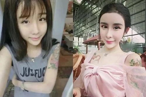 Người phẫu thuật thẩm mỹ có thể bị ngân hàng từ chối cho rút tiền?