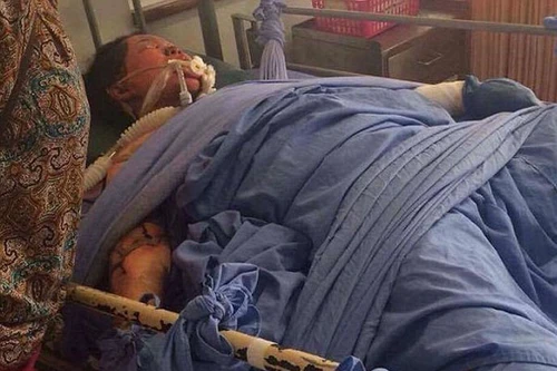 Bị chồng đổ xăng đốt vì đăng ảnh "tự sướng" trên Facebook