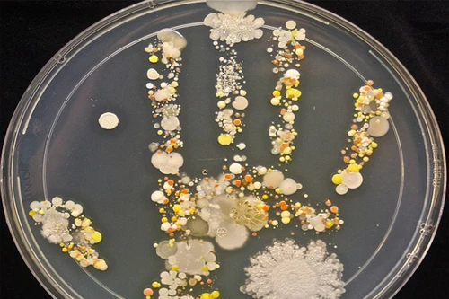 Tay bạn rất “bẩn“?