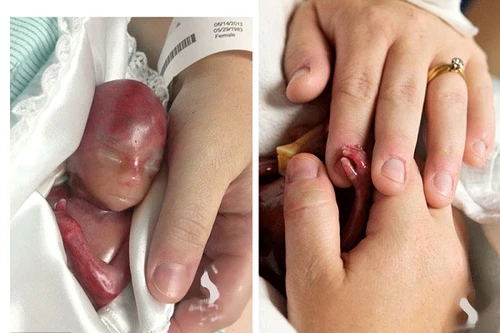 Mẹ đau xót chụp ảnh con vừa sinh đã qua đời sau vài phút