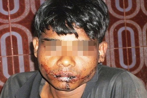 Bỏ mạng vì tự cắt lưỡi để tế nữ thần trong đạo Hindu