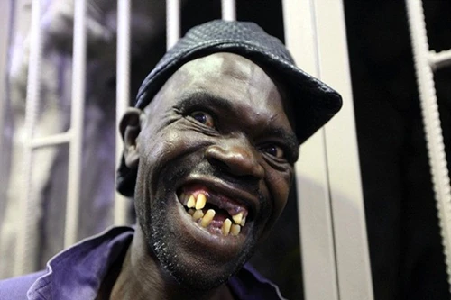 Chiêm ngưỡng dung nhan người đàn ông xấu xí nhất thế giới