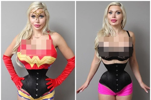 Cô gái cắt phăng 6 xương sườn để có vòng eo con kiến 35cm