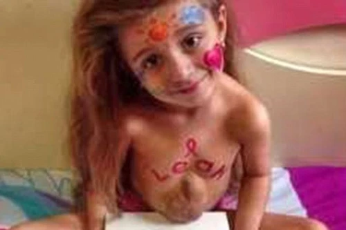 Cuộc sống đầy màu sắc của cô bé có trái tim nằm ở... bụng