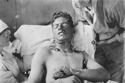 5 loại vũ khí hóa học cực độc bị cấm sử dụng trong chiến tranh 