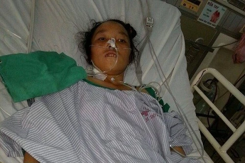 Nữ bệnh nhân có 40 con giun trong ống mật chủ