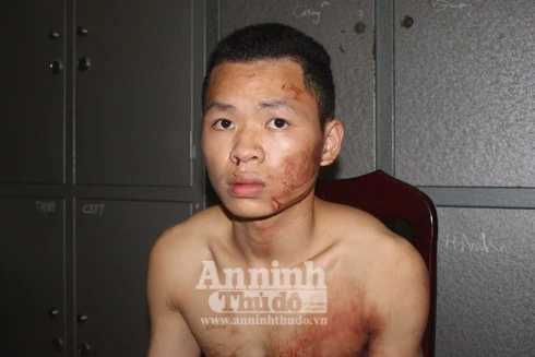  Tận mắt chứng kiến hiện trường vụ 9x sát hại tài xế taxi trên đường Võ Chí Công