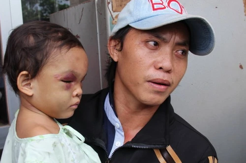 Xuất hiện cha đẻ bé 4 tuổi bị bạo hành