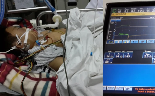 Cháu bé bị bố đánh dã man bằng điếu cày đã tử vong