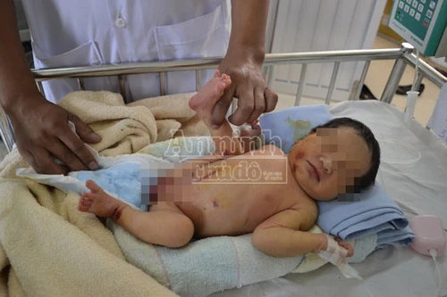 Bé gái 10 ngày tuổi bị bỏ rơi ở bụi tre, dòi, kiến bâu đầy người
