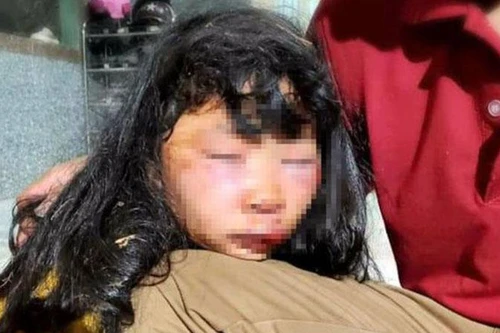 [Tin nhanh sáng 19-3-2021] Nữ sinh lớp 6 bị đánh dã man, bất tỉnh trong lô cao su