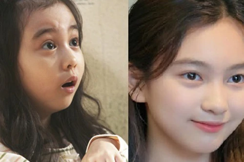 [ẢNH] Màn ‘lột xác’ ngoạn mục của sao nhí phim ‘Điều kỳ diệu ở phòng giam số 7’